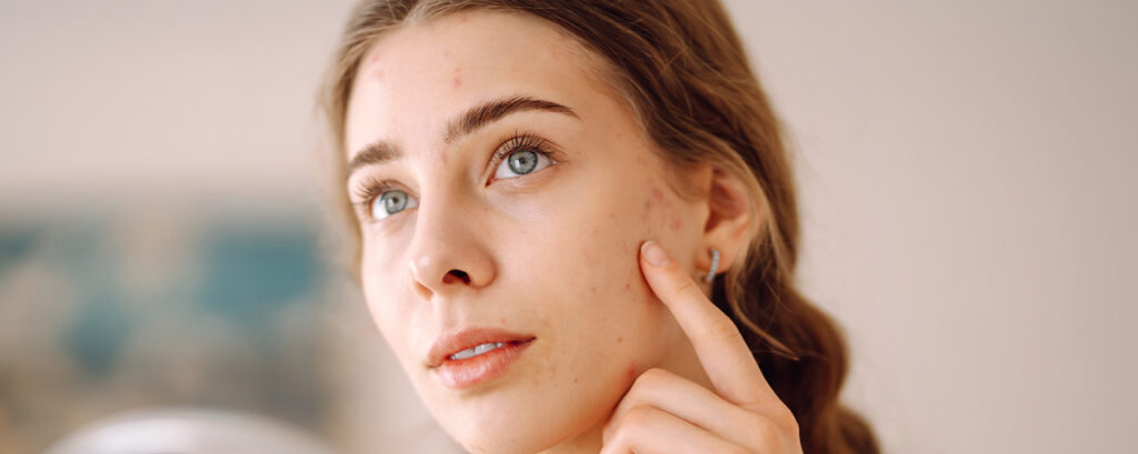 Mujer con piel sensible revisando su rostro para evaluar su hidratación facial