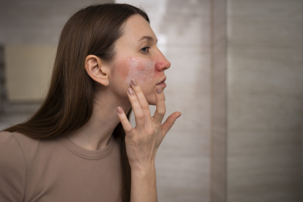 Mujer aplicando una crema hidratante en el rostro como parte de una rutina de cuidado facial para piel seca.